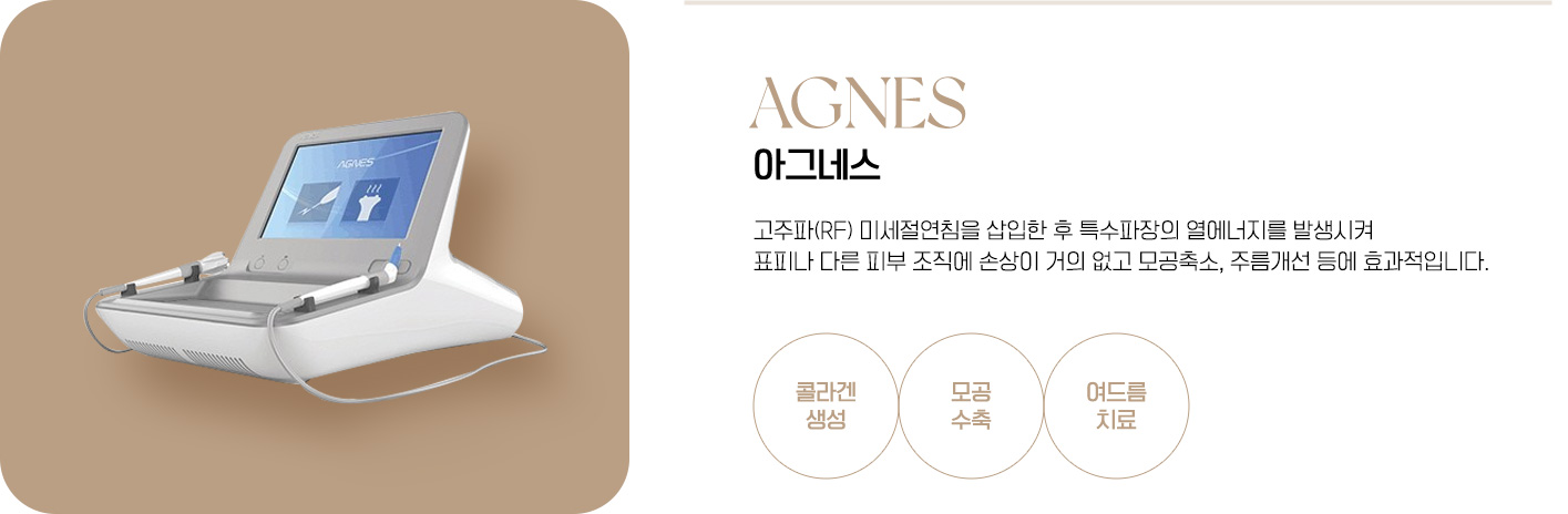 아그네스