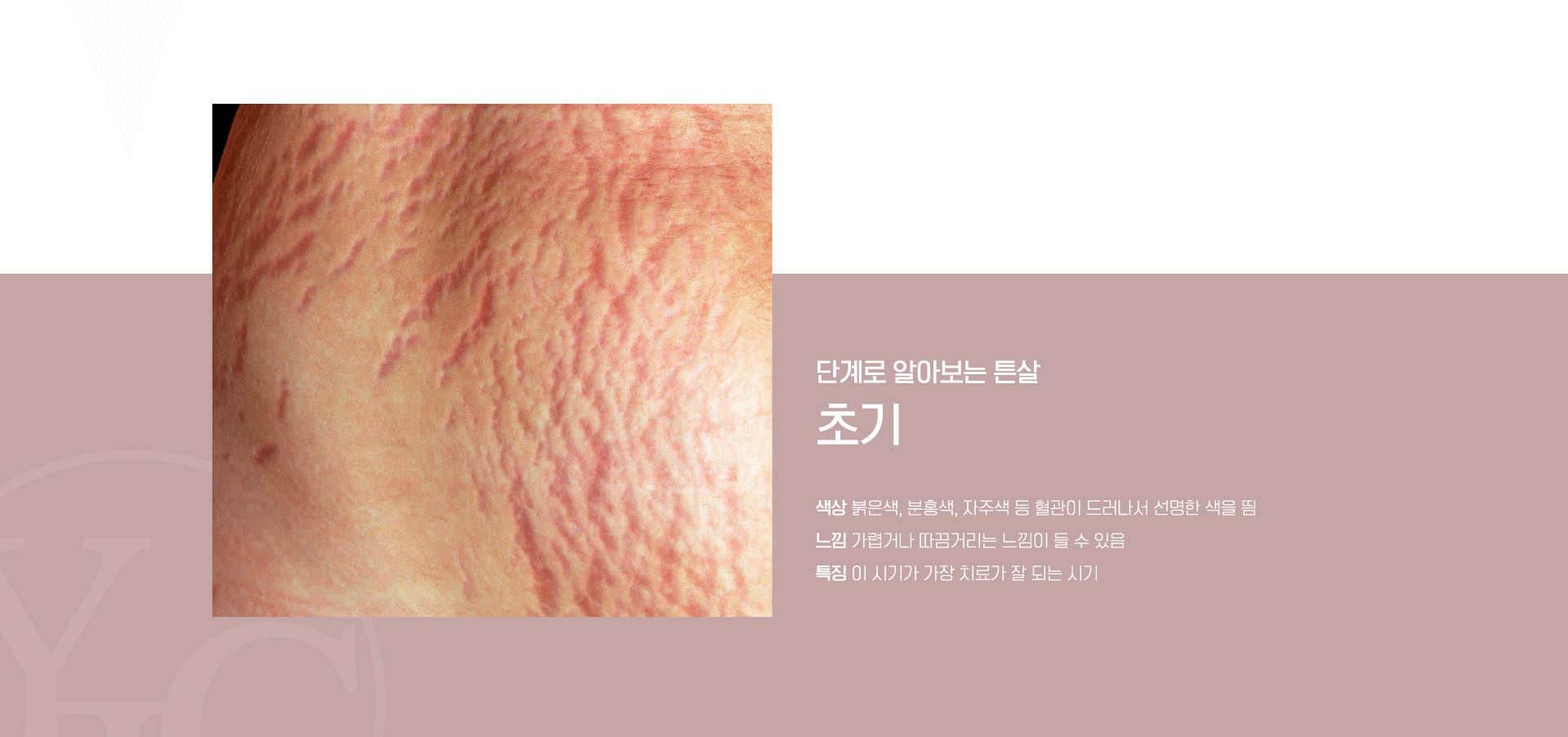 초기