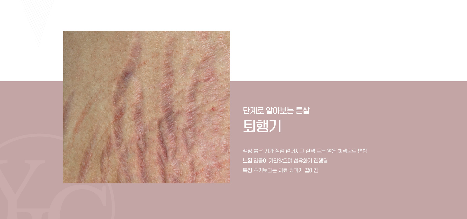 퇴행기