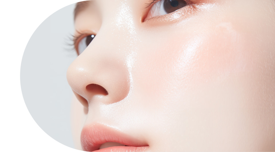 포텐자 여드름 박멸치료 추천대상