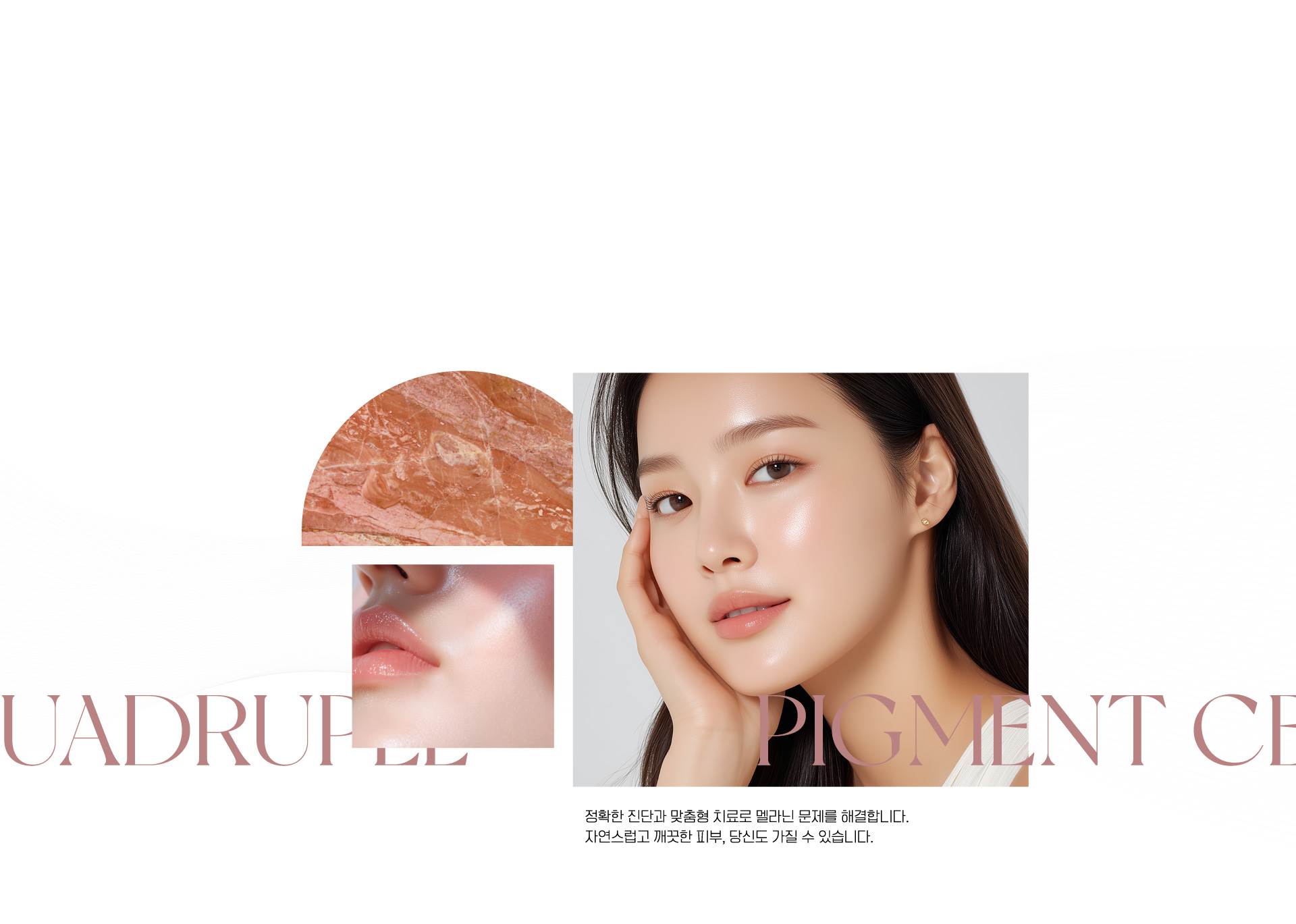 색소 고민, 전문적으로 접근하다.
