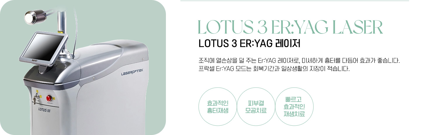 로터스