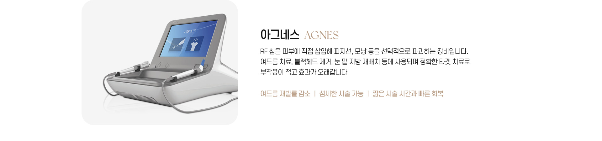 아그네스